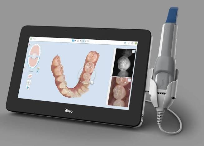 iTero digital scanner